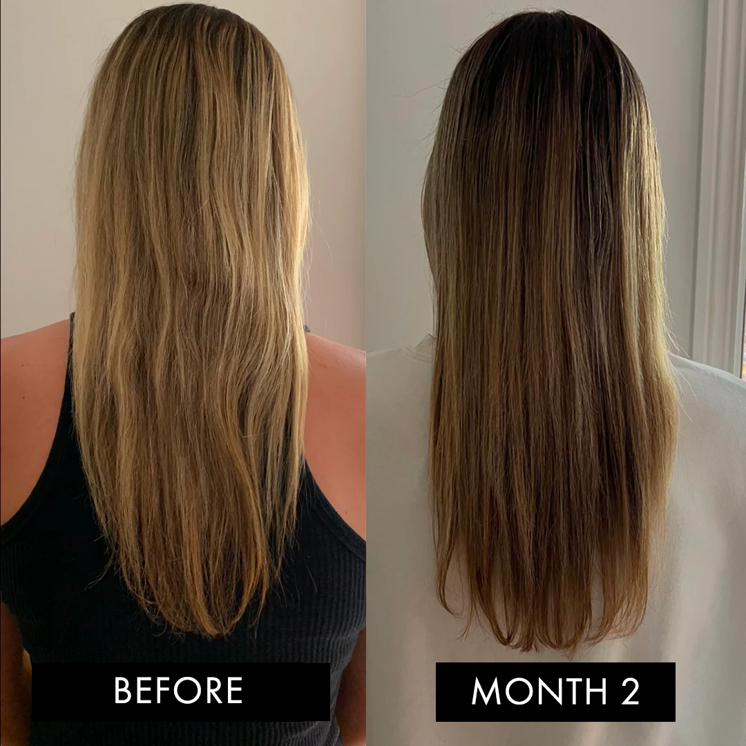 The Hair Elixir Three Month Pack - Image 7